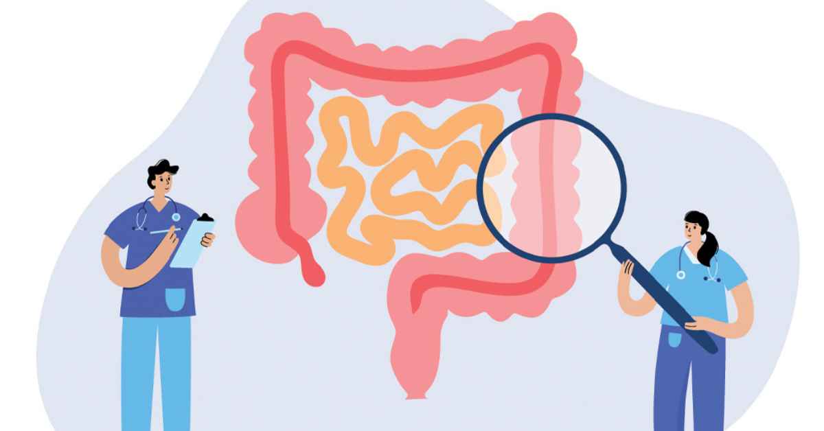 Colorectal Cancer Research