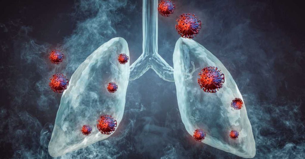 lung cancer clinical trials